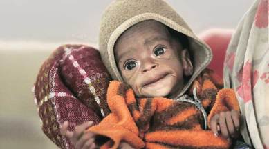 Malnutrition, India Malnutrition, Nutrition report, Global Nutrition Report, India malnutrition level, Ministry of Women and Child Development, RSOC, Food Policy Research Institute, IFPRI, malnutrition in children, Global Nutrition Report 2015, Nutrition Report 2015, International Food Policy Research Institute, Indian express
