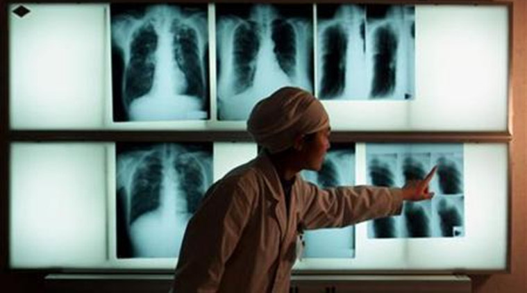pune, pune radiologists strike, pune doctors strike, maharashtra doctors strike, maharashtra health minister, pune news, health news,