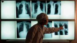 Barack Obama, Narendra Modi, United States Agency, Government of India, TB, HIV/AIDS, indian express