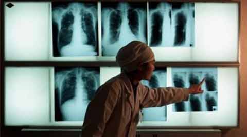 Barack Obama, Narendra Modi, United States Agency, Government of India, TB, HIV/AIDS, indian express