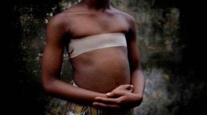 Cutting Boobs And Rap Xxx Videos - Breast-ironing: The absurd African practice to prevent rape | Trending News  - The Indian Express