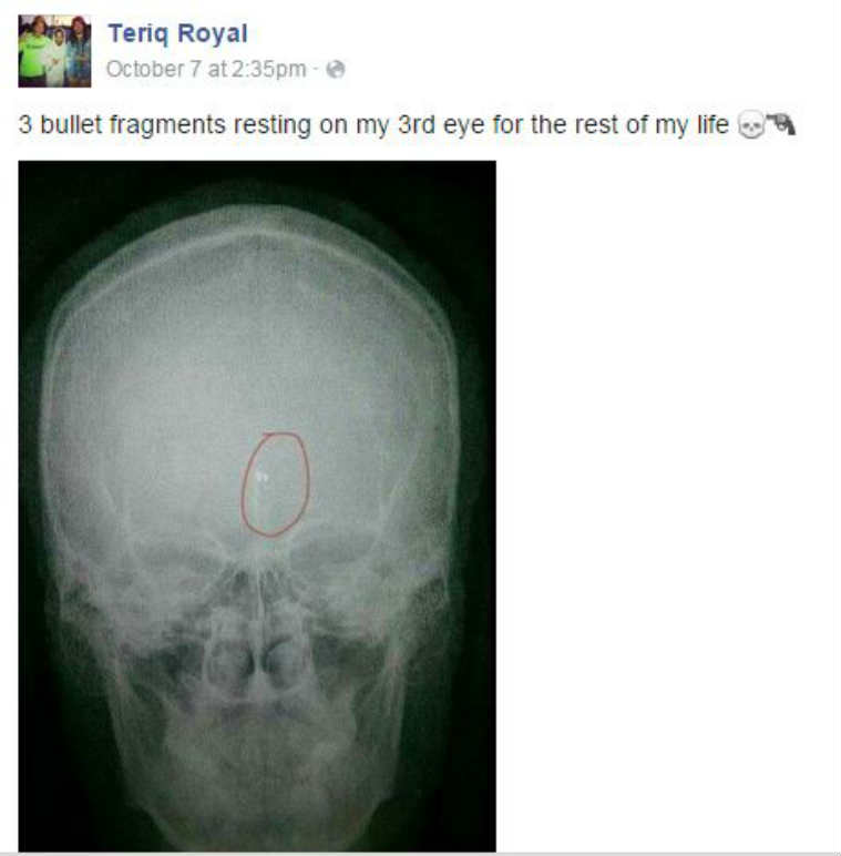 x-ray-759