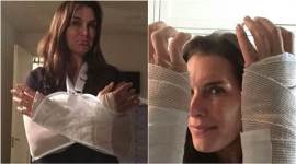 Brooke Shields, Brooke Shields Wrist Surgery, Brooke Shields Writs Injury, Brooke Shields Injured, Brooke Shields Double Wrist Surgery, Brooke Shields Wrist Bandages, Brooke Shields Arm Braces, Entertainment news