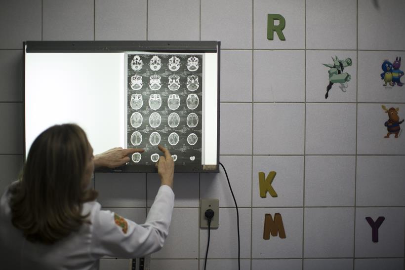 zika, zika virus, zika emergency, WHO zika meeting, WHO zika emergency, zika outbreak, Microcephaly zika, zika symptoms, zika vaccine, zika cure, zika spread, zika news, world news, health news, latest news