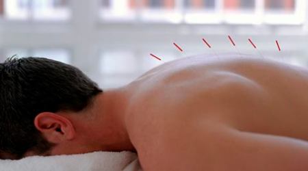 acupuncture, acupuncture therapy, acupuncture sessions, personalised acupuncture, fibromyalgia, pain, pain intensity, chronic pain, fatigue, disordered sleep patterns, depression, hydrotherapy