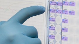 Babasaheb Ambedkar Cantonment Board Hospital, pune hospital, pune kcb hospital pathology labs, pune news, pune hospitals, maharashtra healthcare