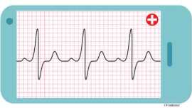 IBM, Pfizer, neurological diseases. Alzheimer’s, Alzheimer’s disease, Alzheimer’s treatment, Alzheimer’s cure, medical advancement, medical tech, medical technology