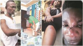 Congolese youth, Congo man death, Africans in Delhi, Africans attacked, Attacks on Africans, African attacked, African attacked in Delhi