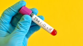 ZIka, Zika virus, Zika infection, Zika spread, Zika virus spread, US Centers for Disease Control and Prevention, Zika research, Zika cure, Zika researcher, World News