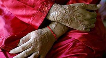 acid attack, UP acid attack, uttar pradesh acid attack, husband attack wife, wife acid attack, woman attack, indian express news, india news