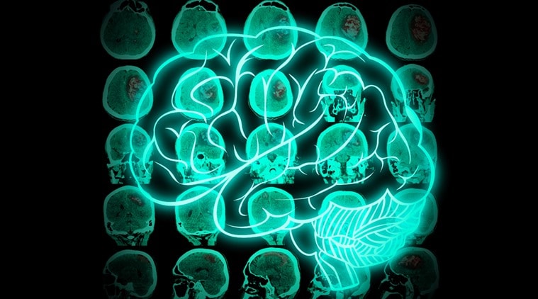 World Brain Tumour Day 2016, brain tumour, tumour, brain tumour causes, brain tumour symptoms, brain tumour treatment, brain tumour cure, brain tumour types, how to detect brain tumour, health news