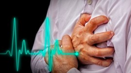 HIV patients, heart attack, HIV, Cardiology, news, latest news, health news, world news