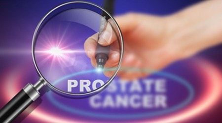 Laser heat could safely treat prostate cancer: Study