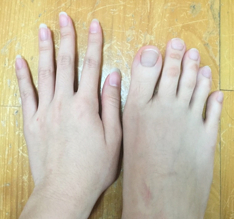 internet-s-going-crazy-over-this-girl-who-has-toes-as-long-as-fingers