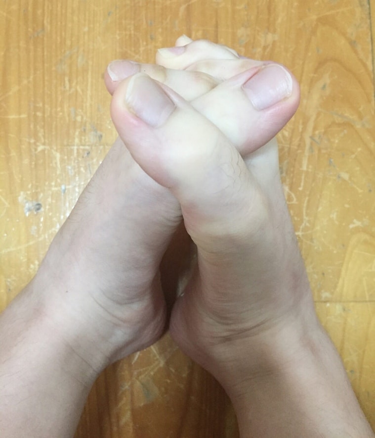 internet-s-going-crazy-over-this-girl-who-has-toes-as-long-as-fingers