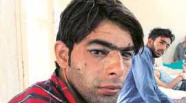 kashmir, kashmir violence, rajnath singh, burhan wani death, kashmir violence, kashmir hospital, jammu kashmir violence, kashmir grenade attack, kashmir clash, burhan wani killing, hizbul mujahideen, hizbul mujahideen commander burhan wani, kashmir curfew, news, india news, latest updates kashmir, india news