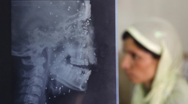 kashmir, kashmir unrest, kashmir human rights, kashmir pellets, kashmir news, india news