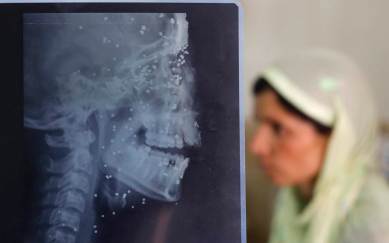 kashmir, Minor boy dies in kashmir, Junaid Akhoon, Pellets use in Kasmir, minor dies of pellet injuries, Pellet gun use in Kashmir, Kashmir violence, Kashmir violence, Kashmir news, Latest news, India news