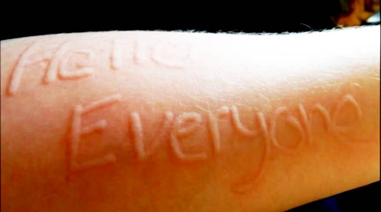 Is It Bad To Write On Your Skin With Pen