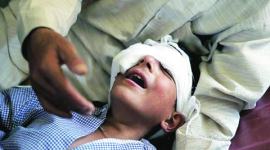 kashmir, kashmir violence, kashmir unrest, kashmir pellets, kashmir pellet guns, kashmir pellet guns injury, Kashmir protests, Jammu and Kashmir High Court, Shri Maharaja Hari Singh Hospital, SMHS Hospital, india news