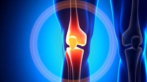 Cartilage repair treatment may prevent joint replacement | Health News ...