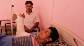 kashmir, pellet guns, kashmir curfew, kashmir unrest, pellet injuries, kashmir ambulance, kashmir situation, pellet guns attack, crpf, burhan wani, kashmir terrorism