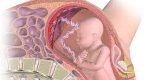 Photo of Baby Still Attached to Placenta by Umbilical Cord