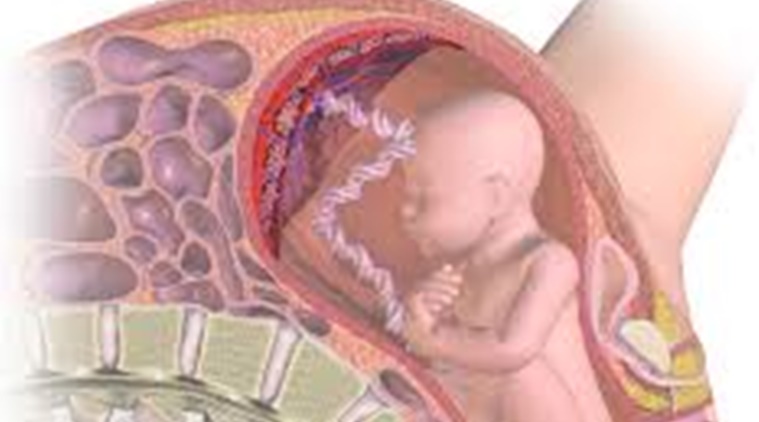 Zika virus, placenta, body virus, body organ, placenta in body, placenta afer birth, infection causing placenta, latest news, health news 