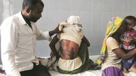 acid-attack-compressed-feature no alt set