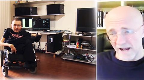 first head transplant, frankenstein surgery, bizzare surgeries in the world, worl'd first head transplant, sergio canavero neurosurgeon, sergio canavero, indian express, indian express news