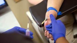 Pradhan Mantri Jan Arogya Yojana, dialysis, kidney problems, pmjay dialysis, dialysis claims, govt health scheme, medical scheme, dialysis scheme, indian express