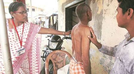 Dadra and Nagar Haveli, Dadra and Nagar Haveli leprosy, Dadra and Nagar Haveli, india leprosy, health news, india news, indian express news