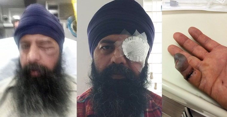 Us Sikh Man Brutally Assaulted Hair Cut By Knife In Alleged Hate 