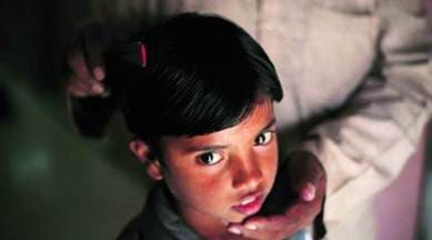 NCPCR, child rights body, rare diseases, Gaucher’s disease, MPS 1, delhi news