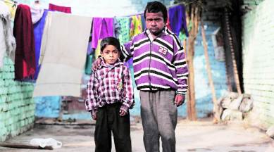 rare diseases, india rare diseases, Gaucher’s disease, Pompe disease, Fabry disease, delhi Gaucher’s disease, delhi Pompe disease, delhi Fabry disease, india news, delhi healthcare, delhi news