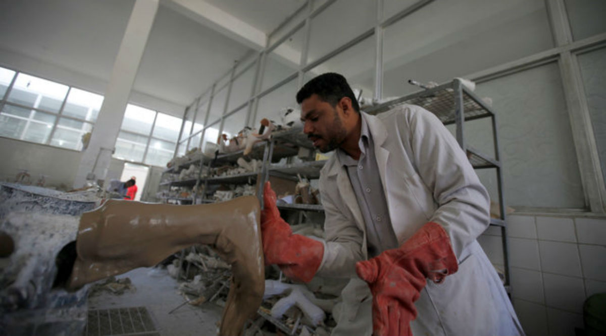 Hairy electronic skin, Robot may soon feel, robotic arms, prosthetic arms, injured patients, prosthetic limbs, war veterans, how to help amputees, artificial hair, Science, Science news