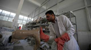 Hairy electronic skin, Robot may soon feel, robotic arms, prosthetic arms, injured patients, prosthetic limbs, war veterans, how to help amputees, artificial hair, Science, Science news