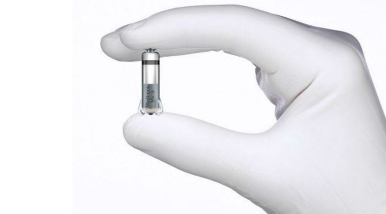 World smallest pacemaker, Pacemaker, Smallest pacemaker in the world, Micra Transcatheter Pacing System, Micra Transcatheter Pacing System unveiled, Smallest pacemaker cost, Smallest pacemaker size, Smallest pacemaker US, science, technology, science news