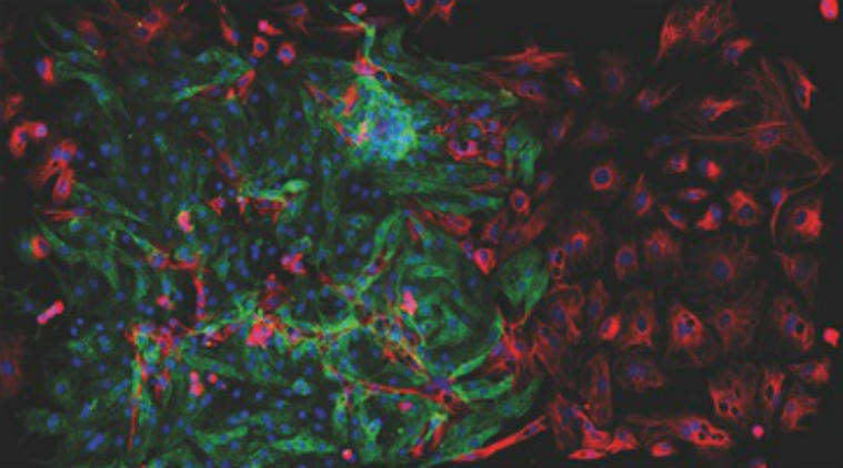 Living diodes, heart cells, biorobots, Bioengineers, Bioengineers,muscle cells, biocomputing,  new treatments for muscular degenerative disorders, treatment for  arrhythmia, treatment for limb loss, single cell options, Science, Science news 