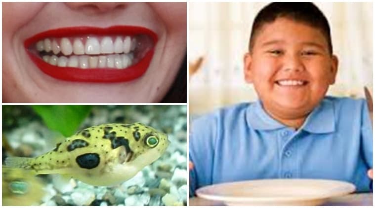 teeth and genes, pufferfish, pufferfish teeth, teeth growth, teeth research, discovery of fish, latest research, research on human teeths, Indian express, indian express news