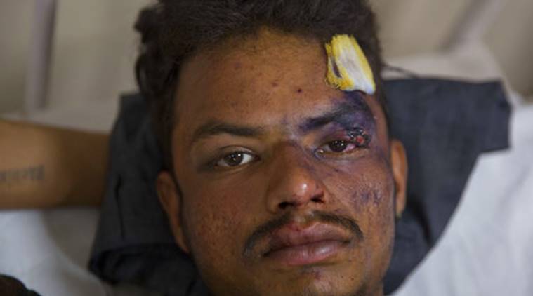 Saharanpur victim, Saharanpur, Saharanpur Rally, Uttar Pradesh Saharanpur Rally, UP Saharanpur Rally, UP Saharanpur victim, UP Mayawati Rally, India News, Indian Express, Indian express News
