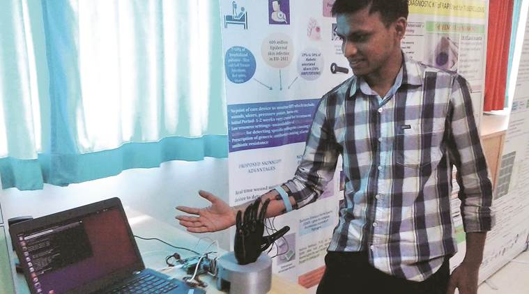 Pune startup, Pune labs, Dee Dee labs, prosthetic hand, Pune news, india news, indian express news