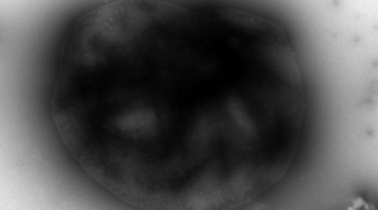 Microbial fuel cells, convert methane to electricity, bacteria, acetate, DNA cloning, aneorbic digester, waste treatment, Bacteria sludge act, humic acids, methanol fuel cell, Science, Science news