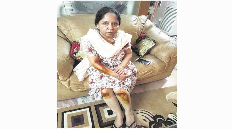 Snatching case, Chandigarh snatching case, Snatching Teacher, FIR registered, Indian express, India news, Latest news