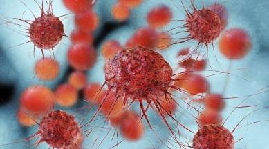 cancer, cancer study, cancer cure, reasons for cancer, any cure for cancer,