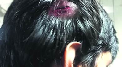 Turquoise Cottage, Turquoise Cottage Green Park, musician attacked, musician assaulted by bar staffs, indian express news