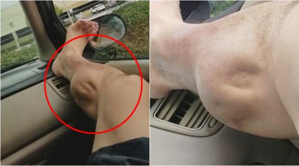 scary cramps video, post workout cramps video, viral cramps video, why do we get cramps, workout cramps, muscle cramps, indian express, indian express news