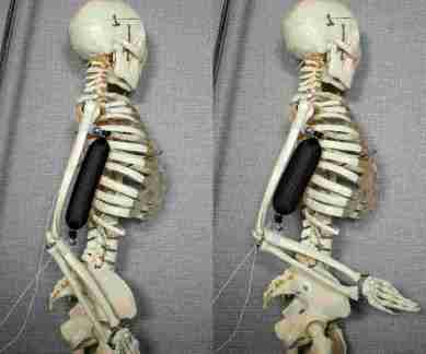 Synthetic soft muscle, 3D-printed muscle, Columbia University, artificial active tissue, intrinsic expansion ability, lifelike robots, environmentally-safe materials, silicone rubber matrix, robotic applications, high stress muscle, high strain muscle