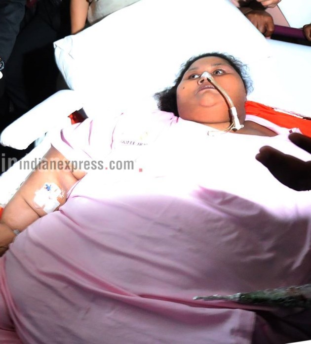 Eman Ahmed Known As Worlds Heaviest Woman Dies In Uae India News News The Indian Express 