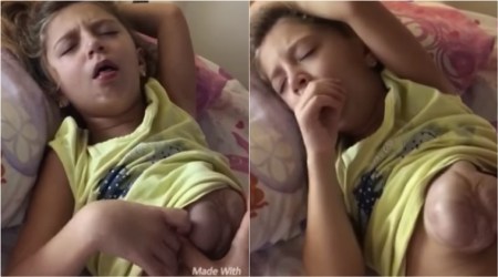 young girl's heart beating outside, girl's heart beating outside, young girl heart beating out of body viral video, shocking video of young girl's heart beating outside, indian express, indian express news